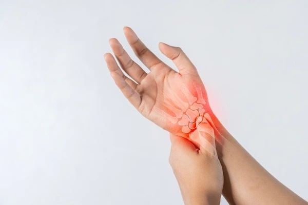 Arthritis Treatment – 21days